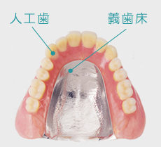 総入れ歯