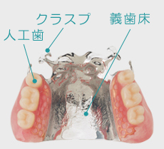 総入れ歯